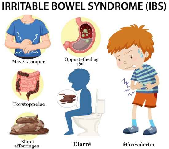IBS Irritabel bowel syndrome 