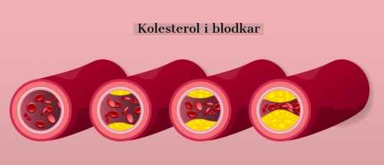 kolesterol
