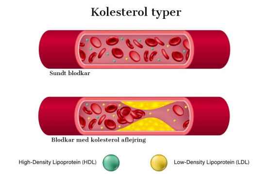Kolesterol typer LDL HDL