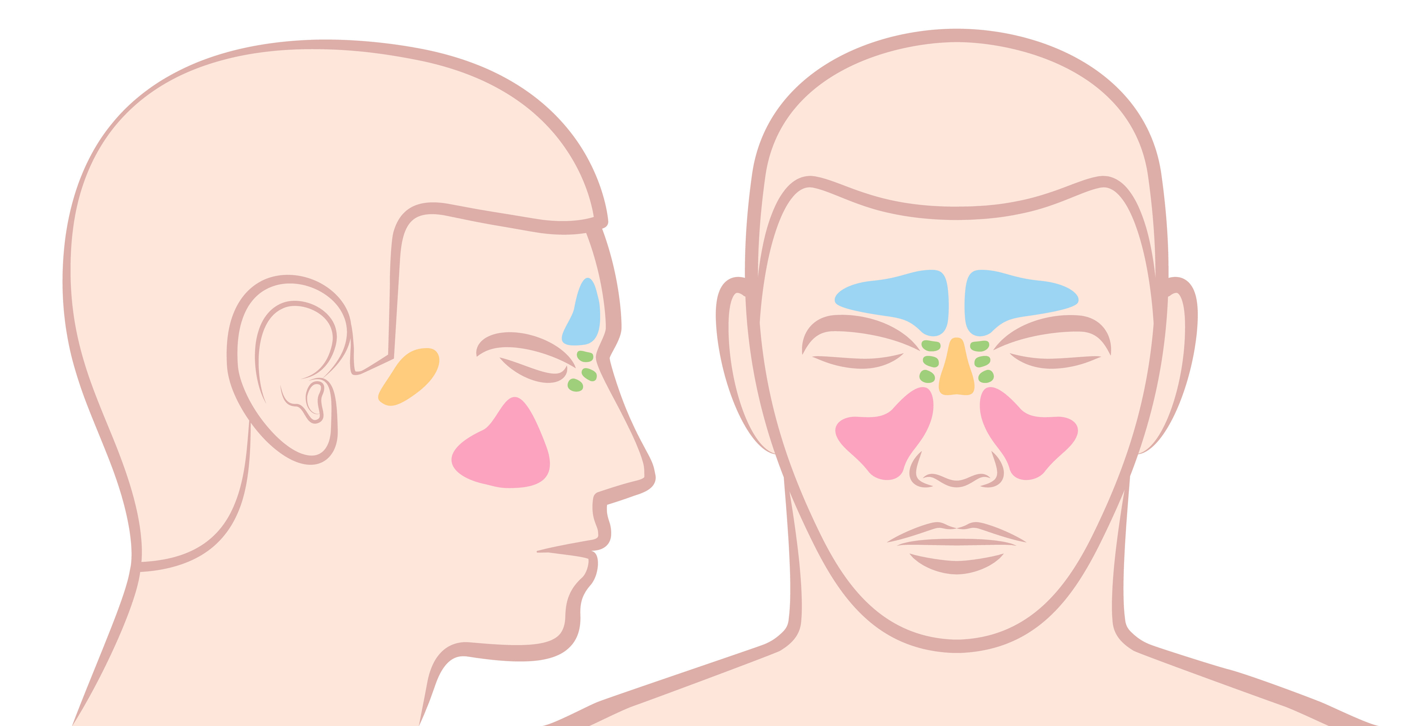 Против синуситов. Paranasal Sinuses. Синусит и снижение слуха.